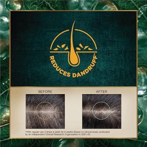 Anti-dandruff Shampoo